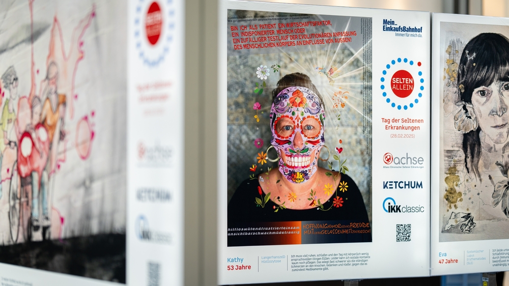 Eindrücke von Selten Allein - Ausstellung im Hauptbahnhof Dresden. Foto: UKD/Kirsten Lassig